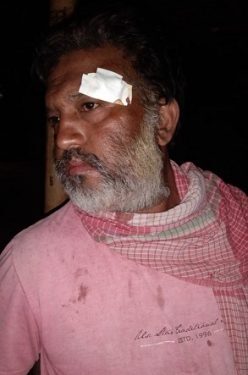 आदित्यपुर में नशेड़ी ने मारपीट कर किया घायल