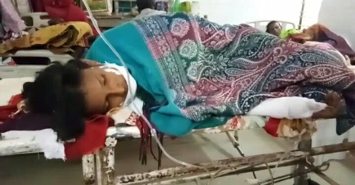 jamshedpur-burning-कपाली में अंडा फ्राई के दौरान झुलसी युवती, घायल