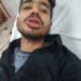 jamshedpur-mgm-hospital-incident-एमजीएम अस्पताल में पुलिस जवान को अस्पताल के ही कर्मचारी के बच्चे ने पीटकर किया घायल, सुरक्षाकर्मियों में गुस्सा