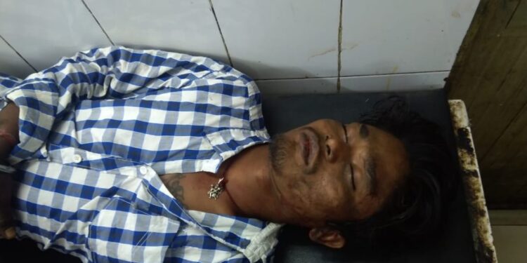 jamshedpur-crime-कदमा में युवक को कुल्हाड़ी से मारकर किया घायल, एमजीएम में भर्ती jamshedpur-crime-कदमा में युवक को कुल्हाड़ी से मारकर किया घायल, एमजीएम में भर्ती