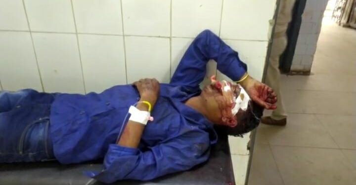 Adityapur : टोल ब्रिज के पास अज्ञात वाहन की चपेट में आकर दो युवक जख्मी, अस्पताल में Adityapur : टोल ब्रिज के पास अज्ञात वाहन की चपेट में आकर दो युवक जख्मी, अस्पताल में