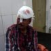 jamshedpur-कदमा भाटिया बस्ती में दो भाइयों ने मिलकर तीसरे भाई की पिटाई की, घर से बाहर निकाला, घायल का एमजीएम में चल रहा इलाज jamshedpur-कदमा भाटिया बस्ती में दो भाइयों ने मिलकर तीसरे भाई की पिटाई की, घर से बाहर निकाला, घायल का एमजीएम में चल रहा इलाज