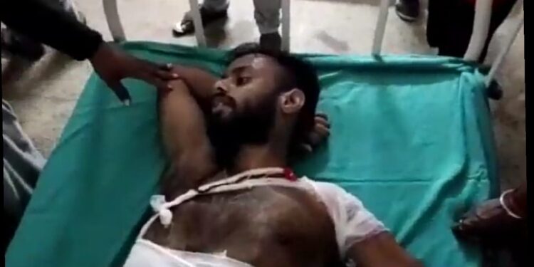 west- singhbhum-सीकेपी के पोर्टर खोली में चाकूबाजी, दो घायल, जमशेदपुर रेफर, दो गिरफ्तार, पुलिस कर रही है पूछताछ west- singhbhum-सीकेपी के पोर्टर खोली में चाकूबाजी, दो घायल, जमशेदपुर रेफर, दो गिरफ्तार, पुलिस कर रही है पूछताछ
