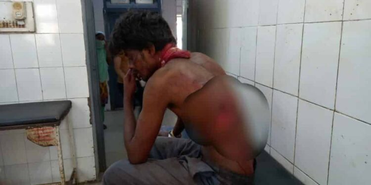 jamshedpur-bagbera- Suspected-illegal- relation-बागबेड़ा में अवैध संबंध रखने के शक में युवक पर धारदार हथियार से हमला कर किया घायल, गंभीर अवस्था में एमजीएम में भर्ती