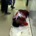 Jamshedpur-road-accident : हाता-चाईबासा मार्ग पर ऑटो ने स्कूटी को मारी टक्कर महिला समेत दो घायल