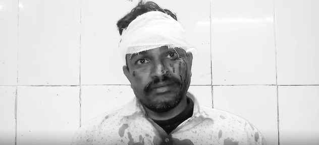 Jamshedpur-crime : काम अधूरा छोड़ा और ले लिए पूरे पैसे, काम पूरा करने की बात पर युवक ने दुकानदार का सिर फोड़ा Jamshedpur-crime : काम अधूरा छोड़ा और ले लिए पूरे पैसे, काम पूरा करने की बात पर युवक ने दुकानदार का सिर फोड़ा