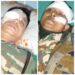jharkhand-two-accident-झारखंड हाईकोर्ट के चीफ जस्टिस के काफिले में शामिल कार दुर्घटनाग्रस्त, रांची से जा रहे थे बिहार, बीच रास्ते में हुआ हादसा, accident-पलामू में सड़क हादसे में बिहार के चार लोगों की मौत, बेटी का तिलक चढ़ाकर लौटते वक्त हुआ हादसा