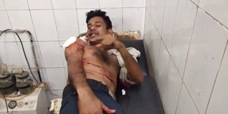 jamshedpur-crime-बर्मामाइंस में चोरी का विरोध करने पर प्राइवेट सिक्योरिटी गार्ड को चाकू से गोदा, लहुलुहान गार्ड की हालत गंभीर-video jamshedpur-crime-बर्मामाइंस में चोरी का विरोध करने पर प्राइवेट सिक्योरिटी गार्ड को चाकू से गोदा, लहुलुहान गार्ड की हालत गंभीर-video