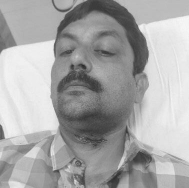 Jamshedpur-Crime : गोलमुरी बाजार में पड़ोस के दुकानदार ने धारदार हथियार से किया हमला, टीएमएच में इलाजरत