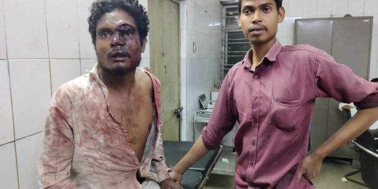 jamshedpur-crime-बिरसानगर में बच्चे की गलती के कारण पड़ोसी ने बच्चे के पिता को मारकर किया घायल jamshedpur-crime-बिरसानगर में बच्चे की गलती के कारण पड़ोसी ने बच्चे के पिता को मारकर किया घायल