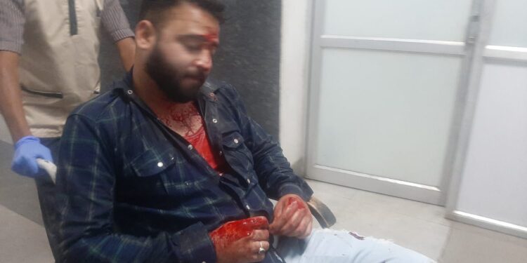 jamshedpur-hungama-बिष्टुपुर होटल रामाडा के सैटरडे नाइट पार्टी में दो पक्षों में जमकर मारपीट, भाजपा के पूर्व जिला अध्यक्ष के बेटे ने काटा बवाल-video-आर्मी जवान गंभीर रूप से घायल-video