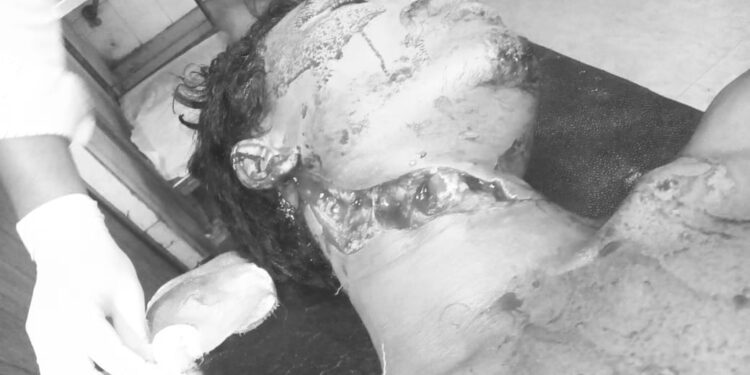jamshedpur-crime-मानगो के बालीगुमा के पास एनएच-33 पर ट्रक चालक से लूट, विरोध करने पर धारदार हथियार से गला रेता jamshedpur-crime-मानगो के बालीगुमा के पास एनएच-33 पर ट्रक चालक से लूट, विरोध करने पर धारदार हथियार से गला रेता