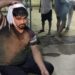 jamshedpur-crime-बर्मामाइंस में पार्किंग को लेकर हरीश के सहयोगियों ने युवक की कर दी पिटाई, लाठी डंडा और रॉड समेत पिस्टल के बट से पीटा
