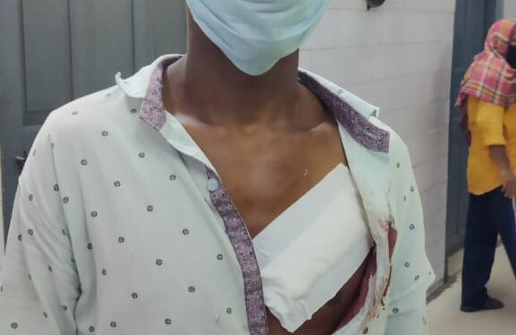 jamshedpur-crime-लोयोला स्कूल के पास फोन कर घर से मिलने बुलाया, फिर धारदार हथियार से हमला कर किया घायल