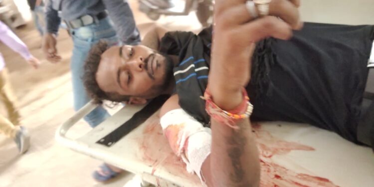 jamshedpur-bagbera-firing-बागबेड़ा में फायरिंग करने वाले लेदा को भी लगी गोली, कहा-बबलू ने पहले चलाई गोली-video-देखिये-video jamshedpur-bagbera-firing-बागबेड़ा में फायरिंग करने वाले लेदा को भी लगी गोली, कहा-बबलू ने पहले चलाई गोली-video-देखिये-video