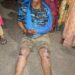 jamshedpur-breaking-बिष्टुपुर में देर रात गाड़ी ने कई लोगों को कुचला, विरोध कर रहे कांग्रेस के एसटी मोर्चा जिला अध्यक्ष समेत अन्य पर पुलिस ने की लाठीचार्ज, हाथ-पैर तोड़ा, हंगामा, पहुंचे डीसी-एसपी, देखिए-video