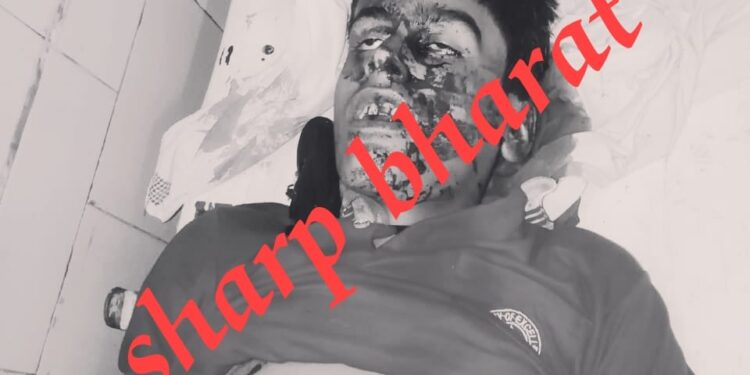 jamshedpur-accident-breaking-बारीडीह में दुखद घटना, बारीडीह बस्ती से साईकल से स्कूल जा रहे एआईडब्ल्यूसी स्कूल के छात्र  की सड़क हादसे में मौत