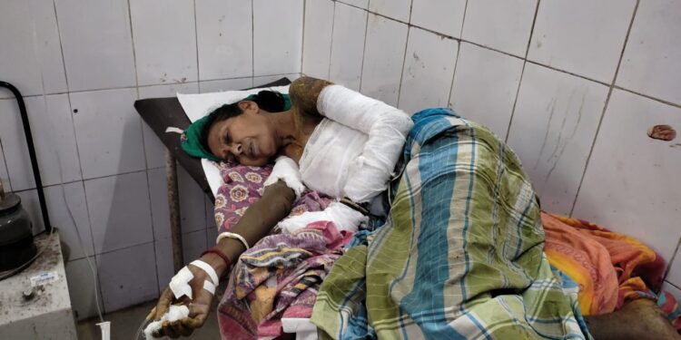 jamshedpur-rural-incident-घाटशिला में पूजा के दिए से जल गई महिला, गंभीर हालत में एमजीएम में चल रहा इलाज