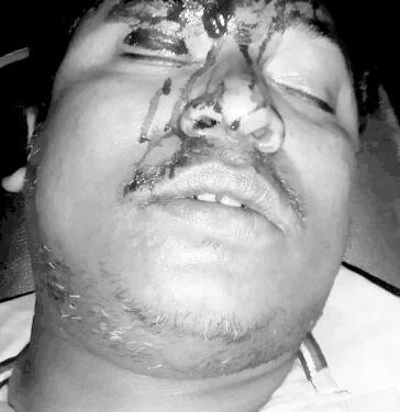Adityapur : आदित्यपुर में तालाब से मिला इच्छापुर निवासी व्यक्ति का शव, हत्या की आशंका, क्षेत्र में सनसनी Adityapur : आदित्यपुर में तालाब से मिला इच्छापुर निवासी व्यक्ति का शव, हत्या की आशंका, क्षेत्र में सनसनी