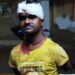 jamshedpur-crime-सीतारामडेरा में पड़ोसी ने पति-पत्नी को हथौड़ा से मारा, पुलिस ने इलाज के लिए भेजा एमजीएम