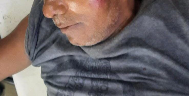 Jamshedpur-accident-सीतारामडेरा में एक हलवाई को ट्रक ने मारी टक्कर, गंभीर