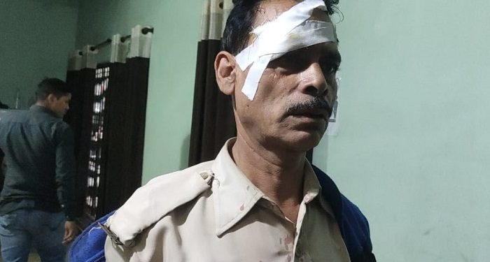 jamshedpur-mgm-hospital-incident-एमजीएम अस्पताल की सुरक्षा में तैनात होमगार्ड के जवान को हेल्मेट से मारकर घायल किया, आरोपी युवक पुलिस हिरासत में-Video jamshedpur-mgm-hospital-incident-एमजीएम अस्पताल की सुरक्षा में तैनात होमगार्ड के जवान को हेल्मेट से मारकर घायल किया, आरोपी युवक पुलिस हिरासत में-Video
