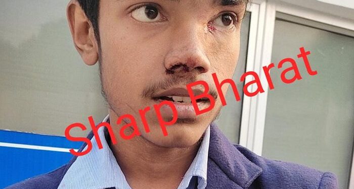 Jamshedpur-Sonari-Attack-on-Student : सोनारी में भारत सेवाश्रम संघ स्कूल के छात्र पर हुआ जानलेवा हमला, आरोपी हिरासत में