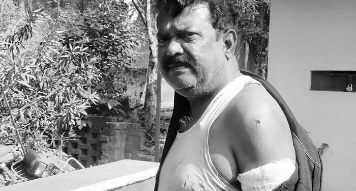 Bokaro : बोकारो के चास में फब्तियां कसने का विरोध करने पर महिला के ससुर को नशेड़ियों ने कैंची मार कर किया घायल