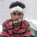 Adityapur : आदित्यपुर के मीरूडीह में पुराने विवाद में दो युवकों पर जानलेवा हमला, लहूलुहान हालत में एमजीएम में भर्ती