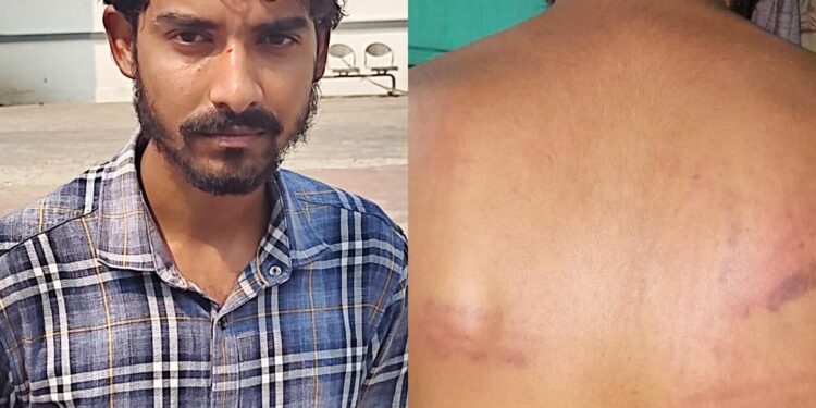 West singhbhum police torture : पश्चिम सिंहभूम के आनंदपुर थाना प्रभारी पर युवक ने मारपीट और झूठा केस में फंसाने का लगाया आरोप, एसपी से की शिकायत, देखिये – video
