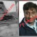 Jamshedpur firing – गोलमुरी में दिनदहाड़े फायरिंग, फल कारोबारी को लगी गोलियां, हालत गंभीर