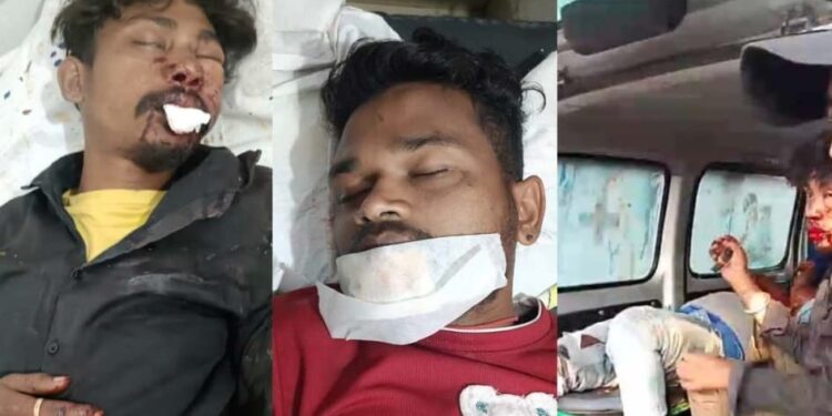 jamshedpur rural accident- कमलपुर में ओवरटेक करने के चक्कर में दो बाइकों में टक्कर, तीन घायल, एक गंभीर