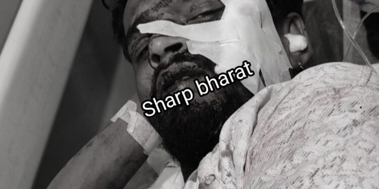 Jamshedpur youth attack – उलीडीह में नशे में धुत युवक ने दोस्त पर किया चाकू से हमला, आरोपी फरार, चोरी के मामले में 3 मार्च को जेल से छूटकर आया था बाहर Jamshedpur youth attack – उलीडीह में नशे में धुत युवक ने दोस्त पर किया चाकू से हमला, आरोपी फरार, चोरी के मामले में 3 मार्च को जेल से छूटकर आया था बाहर