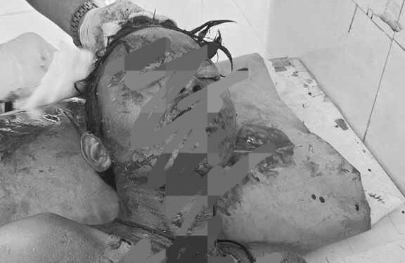 jamshedpur rural accident- कालिकापुर में सड़क दुर्घटना, 9वीं के तीन छात्र गंभीर रूप से घायल, हल्दीपोखर से परीक्षा देकर लौट रहे थे घर jamshedpur rural accident- कालिकापुर में सड़क दुर्घटना, 9वीं के तीन छात्र गंभीर रूप से घायल, हल्दीपोखर से परीक्षा देकर लौट रहे थे घर