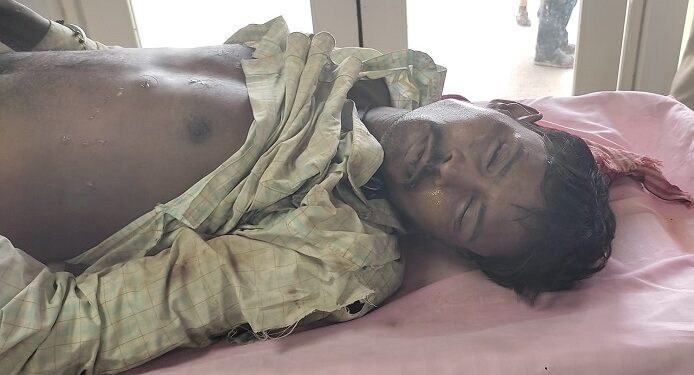 Jamshedpur heat stoke death case – मानगो में लू से मृत मजदूर की हुई शिनाख्त, कपाली का रहने वाला था मृतक