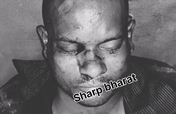 Jamshedpur heatstroke death : जमशेदपुर में जानलेवा हुई गर्मी, लू लगने से अब तक महिला सहित तीन की मौत