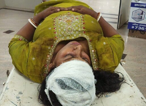 Jamshedpur weapon attack – गोलमुरी में महिला पर चापड़ से हमला, बीजेपी महिला कार्यकर्ता व उसके पुत्र पर हमला करने का आरोप, देखिए – video Jamshedpur weapon attack – गोलमुरी में महिला पर चापड़ से हमला, बीजेपी महिला कार्यकर्ता व उसके पुत्र पर हमला करने का आरोप, देखिए – video