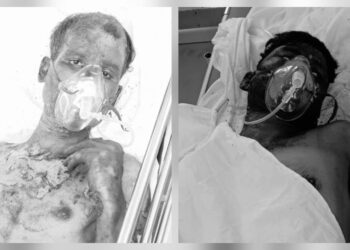 saraikela chandil blast- चांडिल स्थित गैलेक्सी इंगोट प्लांट में ब्लास्ट, दो मजदूर झुलसे, टीएमएच में भर्ती