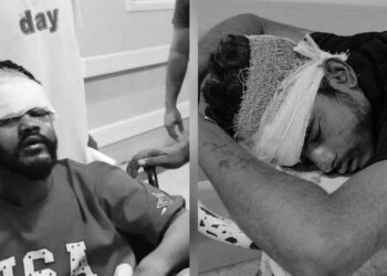 Jamshedpur accident – सुंदरनगर में तेज रफ्तार दो बाइकों की आमने-सामने टक्कर, तीन घायल