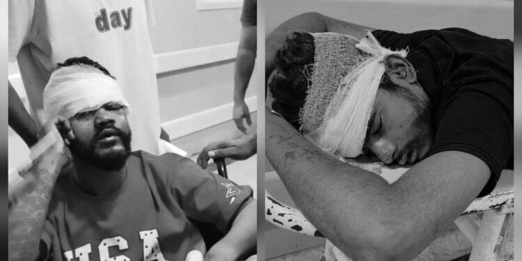 Jamshedpur accident – सुंदरनगर में तेज रफ्तार दो बाइकों की आमने-सामने टक्कर, तीन घायल