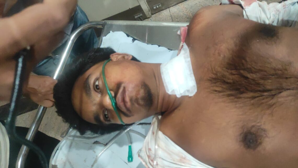 Jamshedpur firing : बालीगुमा के पास अपराधियों ने राजनगर के युवक को मारी गोली, देखिये – video Jamshedpur firing : बालीगुमा के पास अपराधियों ने राजनगर के युवक को मारी गोली, देखिये – video