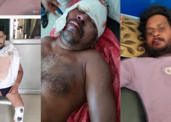 Jamshedpur rural  bike accident : कमलपुर के कांकीडीह में दो बाइकों में सीधी टक्कर, तीन लोग गंभीर रूप से जख्मी