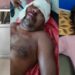 Jamshedpur rural  bike accident : कमलपुर के कांकीडीह में दो बाइकों में सीधी टक्कर, तीन लोग गंभीर रूप से जख्मी