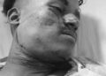 west singhbhum accident-किरीबुरू- बड़ाजामदा मुख्य मार्ग पर सड़क हादसा, अनियंत्रित बाइक दुर्घटनाग्रस्त, एक की मौत, दूसरा घायल
