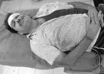 Jamshedpur rural nh accident – एनएच 49 पर सड़क दुर्घटना में बाइक सवार शिक्षक गंभीर रूप से घायल, हालत नाजुक