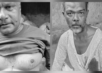 Jamshedpur crime : साकची में रंगदारी नहीं देने पर चाकू से हमला, दो घायल