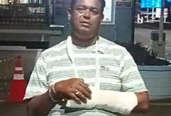 Jamshedpur attack – घोड़ाबांधा में वार्ड सदस्य पर जानलेवा हमला, हाथ टूटा, देखिए – video Jamshedpur attack – घोड़ाबांधा में वार्ड सदस्य पर जानलेवा हमला, हाथ टूटा, देखिए – video