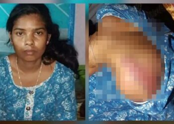Jamshedpur border area police brutality: कपाली पुलिस पर आदिवासी युवती से मारपीट का आरोप, पूछताछ के लिए बुलाकर बंद कमरे में की पिटाई, पीड़िता ने सुनाई आपबीती