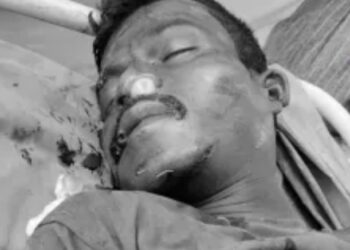 Saraikela chandil accident : चांडिल सड़क दुर्घटना में अज्ञात व्यक्ति की मौत, शिनाख्त में जुटी पुलिस