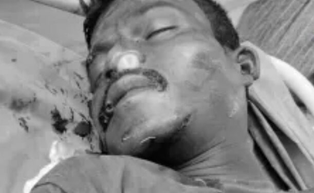 Saraikela chandil accident : चांडिल सड़क दुर्घटना में अज्ञात व्यक्ति की मौत, शिनाख्त में जुटी पुलिस